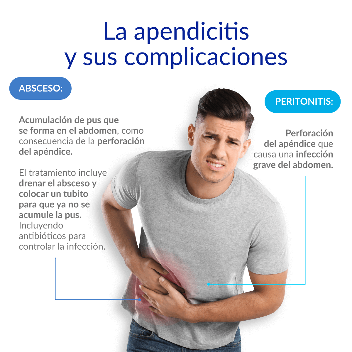 Médica Sur: Apendicitis