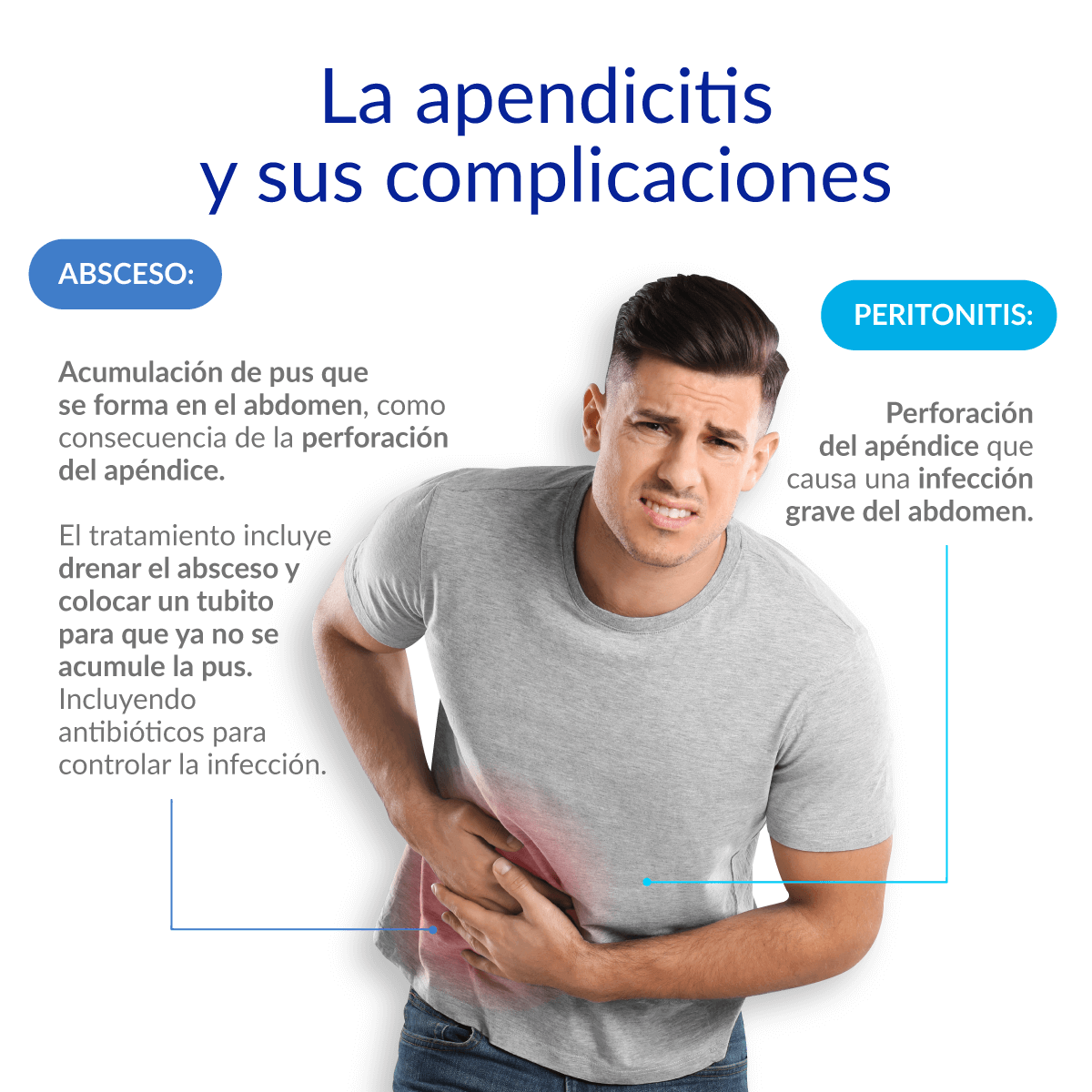 apendicitis